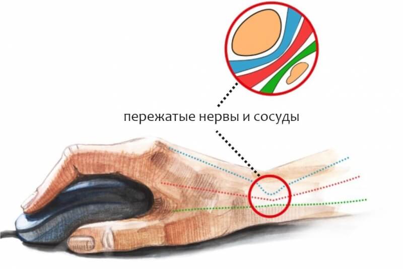 Что такое кракен маркет